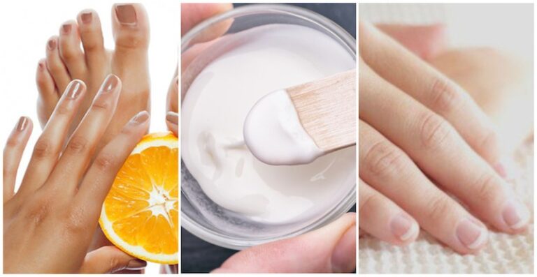 11 Home Remedies To Get Rid of Dark Knuckles