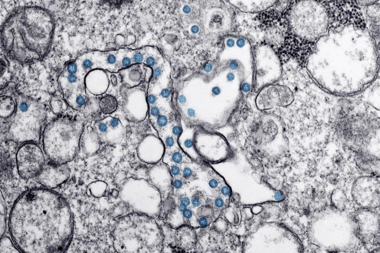 Antibody evolution may predict COVID-19 outcomes