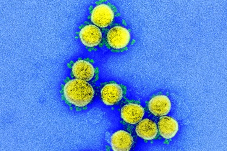 At-home COVID-19 test study launches in Boston