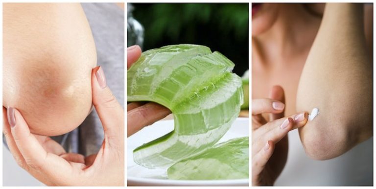 10 Tips To Soften Dry Skin on Elbows